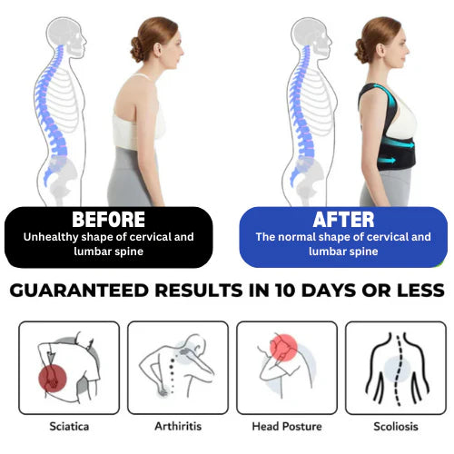 Corecared™ Posture Corrector